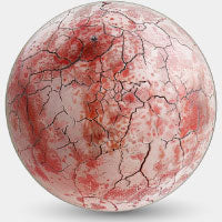 Psoriasis