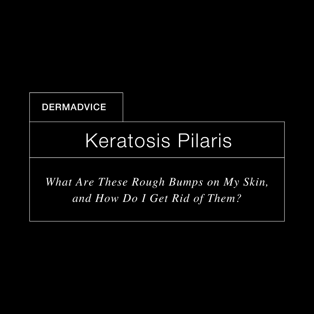 DermExcel™ | Blog post: Keratosis Pilaris